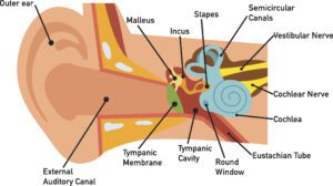 A medical diagram of the human ear showing how hearing loss can occur